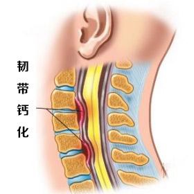 韧带.jpg